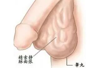 精索靜脈曲張，手術(shù)還是等待？