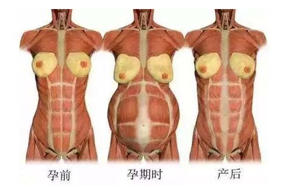 產(chǎn)后媽媽骨盆修復(fù)――帶你回到完美身材！