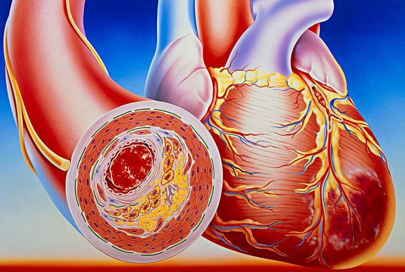 看清心臟動脈，判斷病癥，及早治療冠心?。?></a></div>
               
 					<div   id=