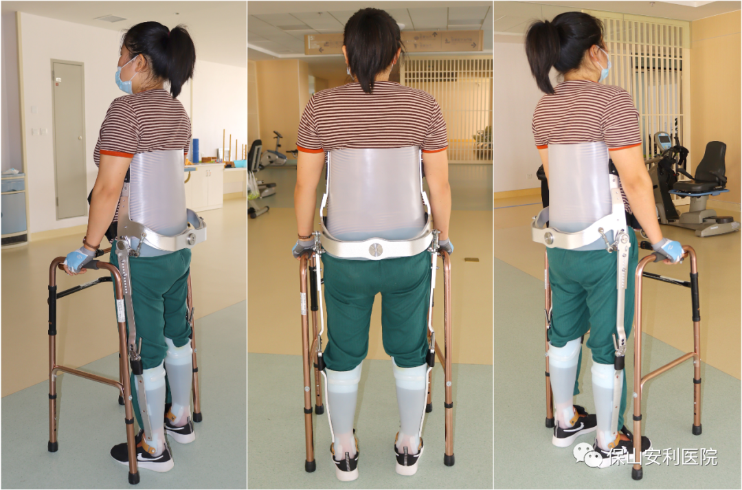 【保山安利醫(yī)院】意外墜樹導致截癱，量身定制截癱步行器（RGO）幫助患者逐步恢復行走能力！