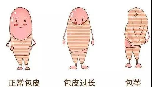 【保山安利醫(yī)院】家長速看！暑期包皮手術預約正當時！