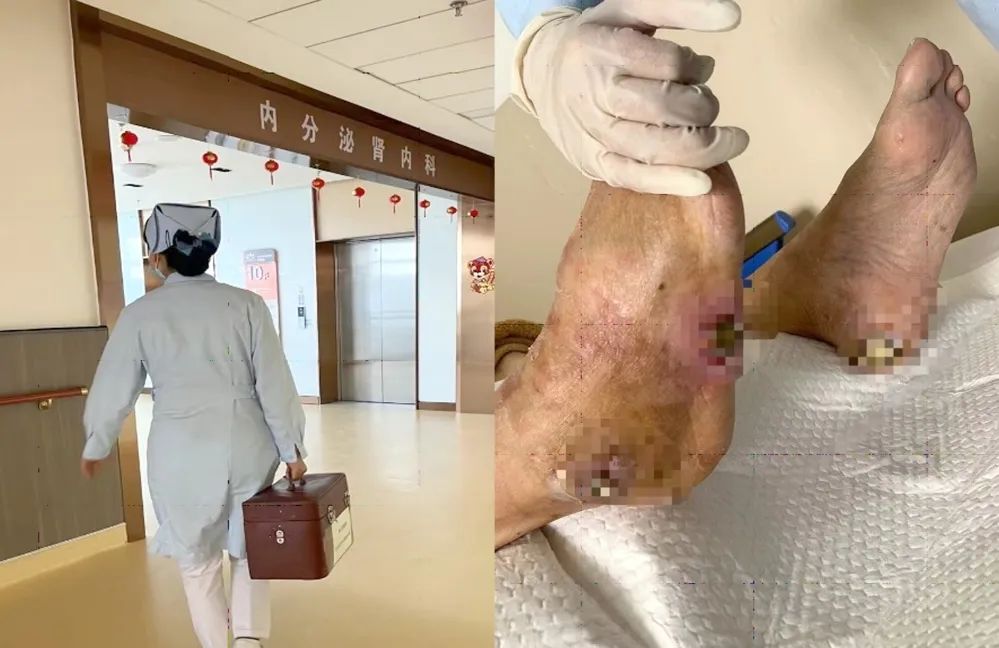 【保山安利醫(yī)院】傷口治療一站式，健康生活零距離！